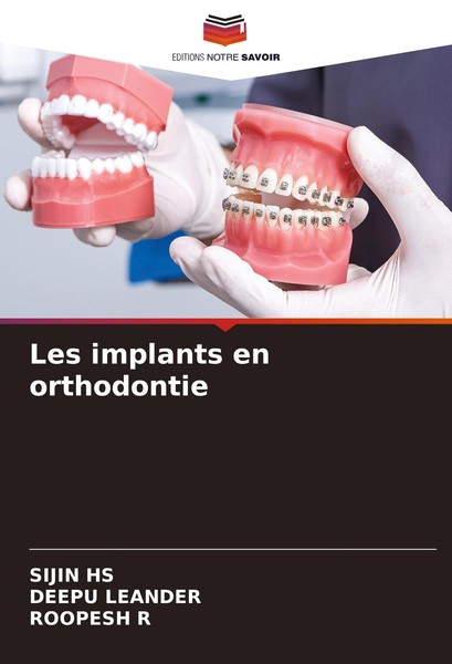Les Implants En Orthodontie Sijin Hs-image