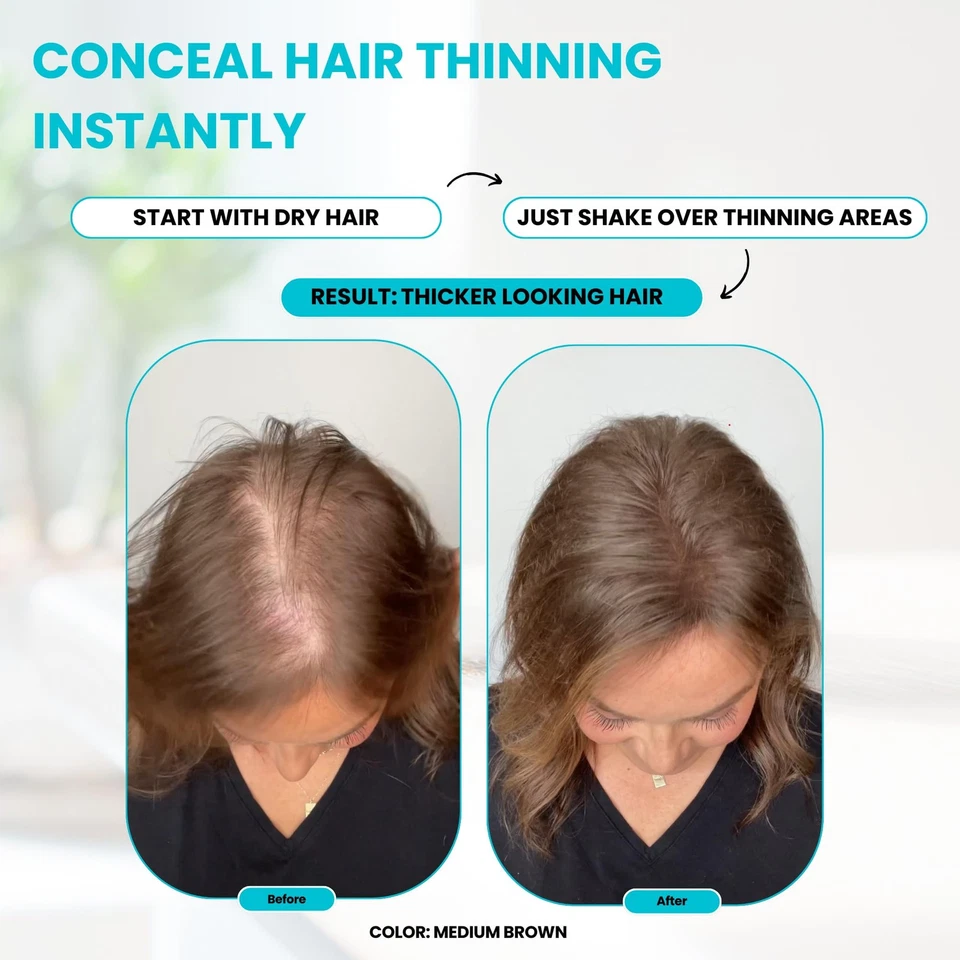 Fibras capilares, 15 g (negro), rellena el adelgazamiento del cabello para un aspecto visiblemente más completo, concea... Foto 2 de 4