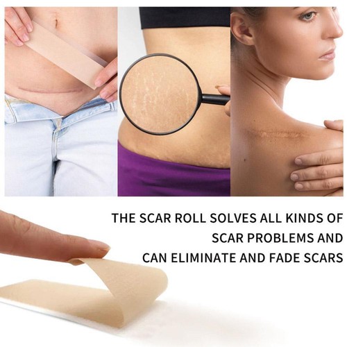 Silicone Scar Sheet MEDICAL GRADE Scar Removal Silicone Tape Treatment NEW. - Picture 6 of 12