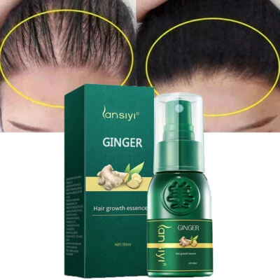 LANSIYI Hair Growth Serum Spray Fast Hair Growth Liquid Thinning Grow Scalp Treatments