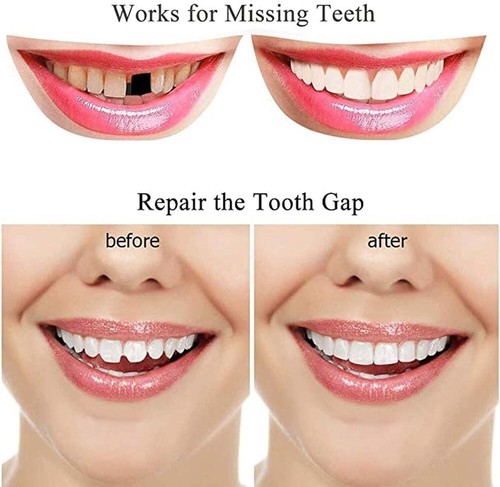 Set denti finti Smile Snap on per mangiare e bere faccette protesi dentale copertura denti - Foto 22 di 24