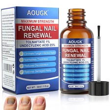Toenail Fungus Treatment Extra Strength 25 Undecylenic Acid Nail Fungus Cream