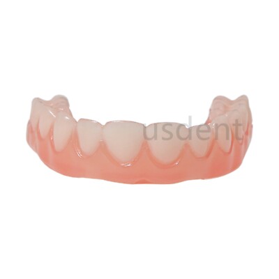 Modèle Dentaire Typodont Implant All On 4 - Mâchoire Supérieure Et Inférieure Amovible - Neuf
