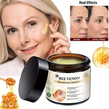 Bee Venom Skin Restoration Cream, Professional Bee Venom Skin Treatment Cream US