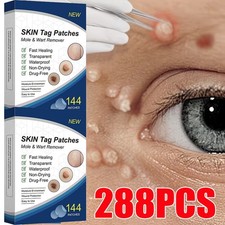 Skin Tag Remover Patches Quick Effective Mole and Wart Pad Removal Sticker US