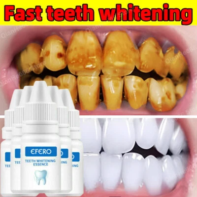 EFERO 5/3Pcs Teeth Whitening Serum Oral Cleaning Remove Plaque Stains Tooth Bleaching