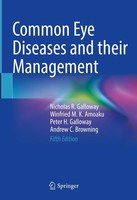 Common Eye Diseases And Their Management Andrew C. Browning