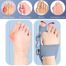 Hallux Valgus Big Toe Bunion Corrector Straightener Pain Relief SplintSeparator