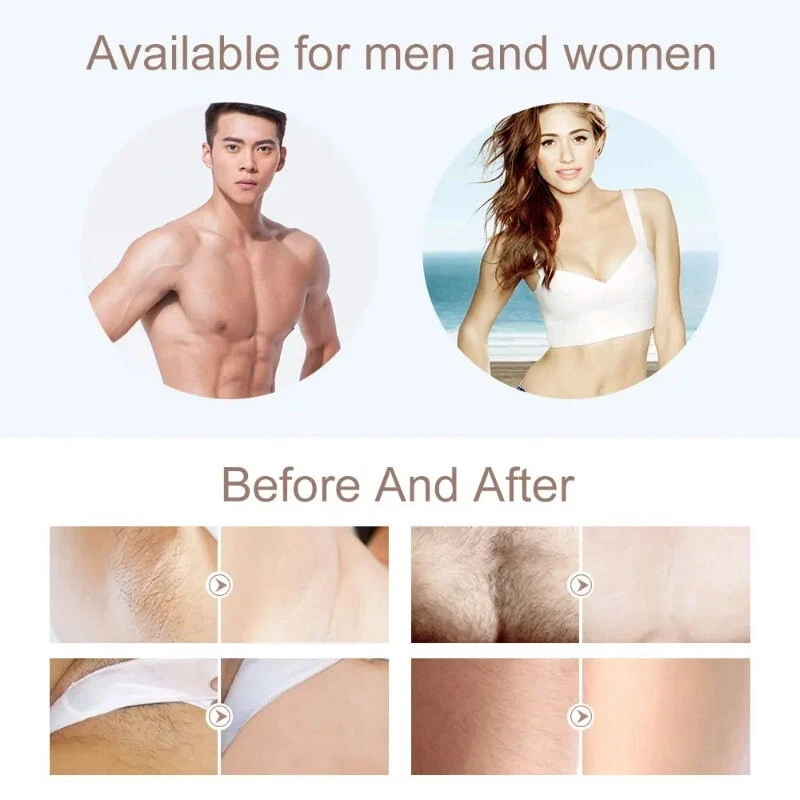 BDI Permanent IPL Hair Removal Device 400K Pulses Intense Pulsed Light Epilator - Picture 13 of 24