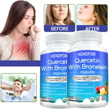 Quercetin Bromelain 1200mg Vegan Capsules 98% Genuine Extract Strong Supplement