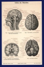 Gehirn - Druck anno 1895 - Thalamus Hippocampus Medizin Hirn Cerebrum Anatomie