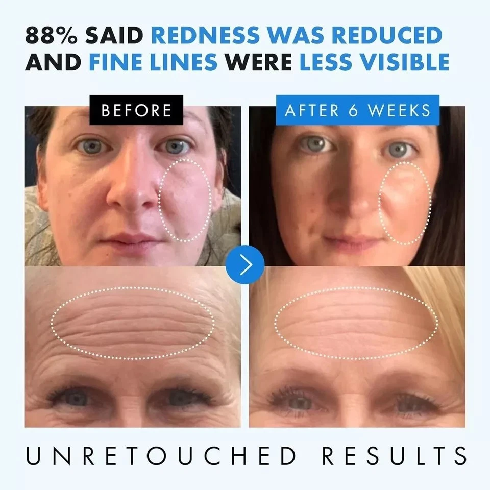 Hyaluronic Acid 100% Pure Organic Anti Aging Hydrating Serum Wrinkles Fine Lines - Image 2 of 4