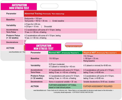 Antepartum Non Stress Test Reference Horizontal Badge Card - Excellent Resource