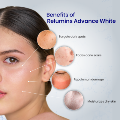 oral glutathione before after 3 Bottles of Relumins Advanced White Oral Glutathione Whitening Formula  Strength for sale online