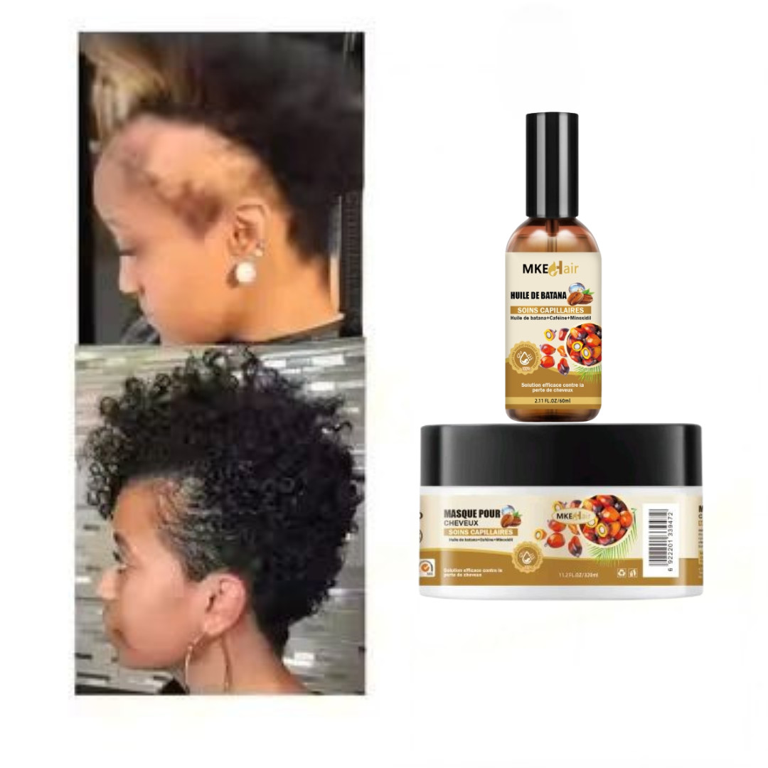 Kit croissance cheveux magique à l'huile de Batana pure pour stimuler la repousse des bulbes 250ml