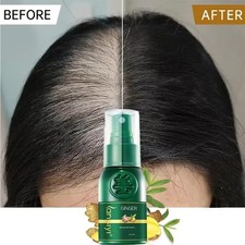 Ginger Ginseng Hair Regrowth Serum Spray Growth Essence Anti-Loss Treatment
