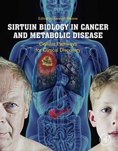 Sirtuin Biology in Cancer and Metabolic Disease, Maiese,#