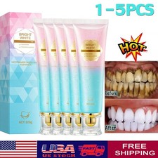 Niacinamide Whitening Toothpaste,Natural Niacinamide Toothpaste,Teeth Whitening