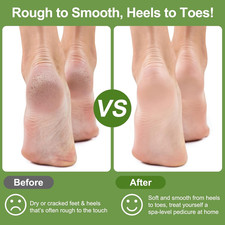Pumice Stone for Feet, 3 Pack Natural Earth Lava Foot Callus Remover Pedicu...