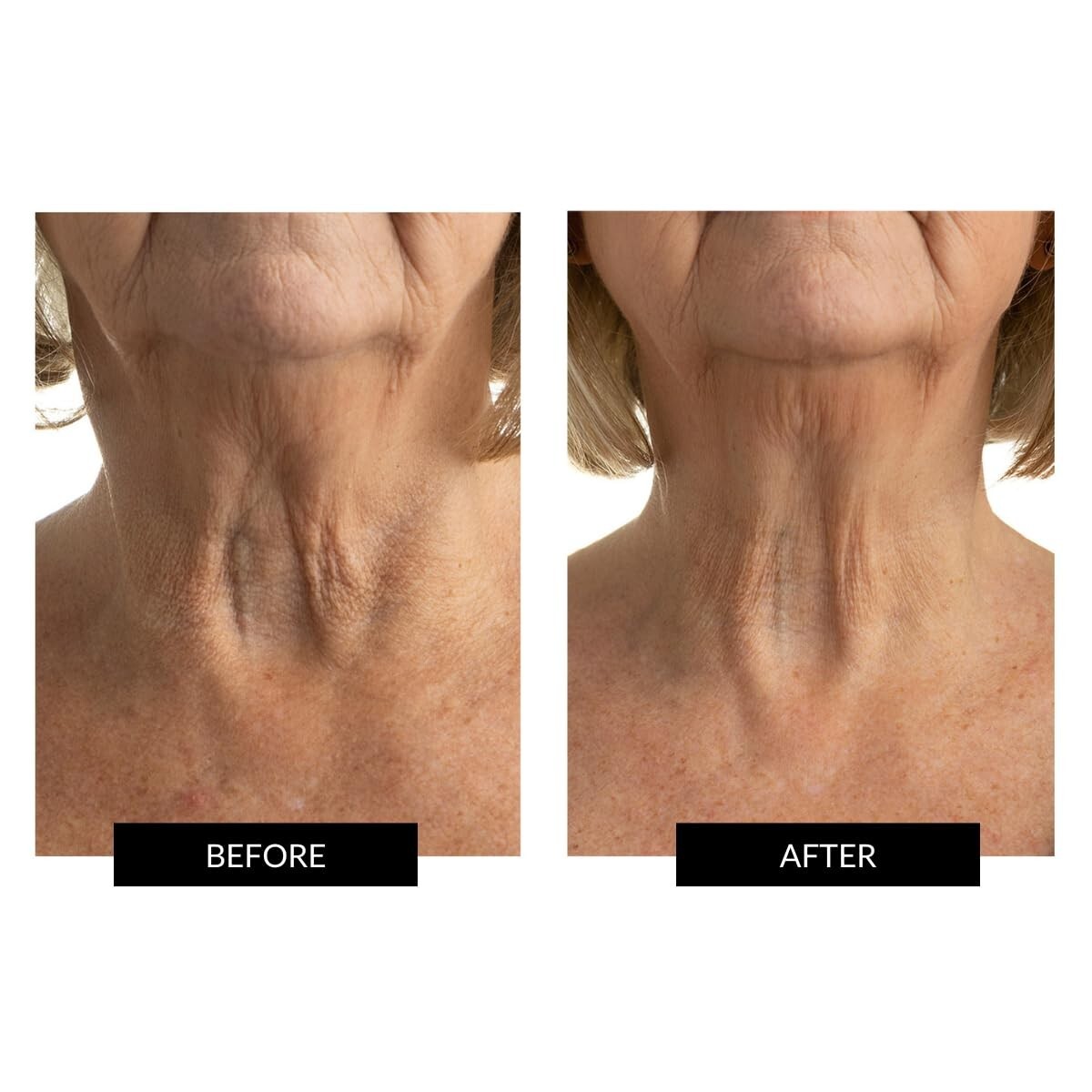 CurrentBody Skin LED Neck and Dec Perfector | Fully Wearable Anti
