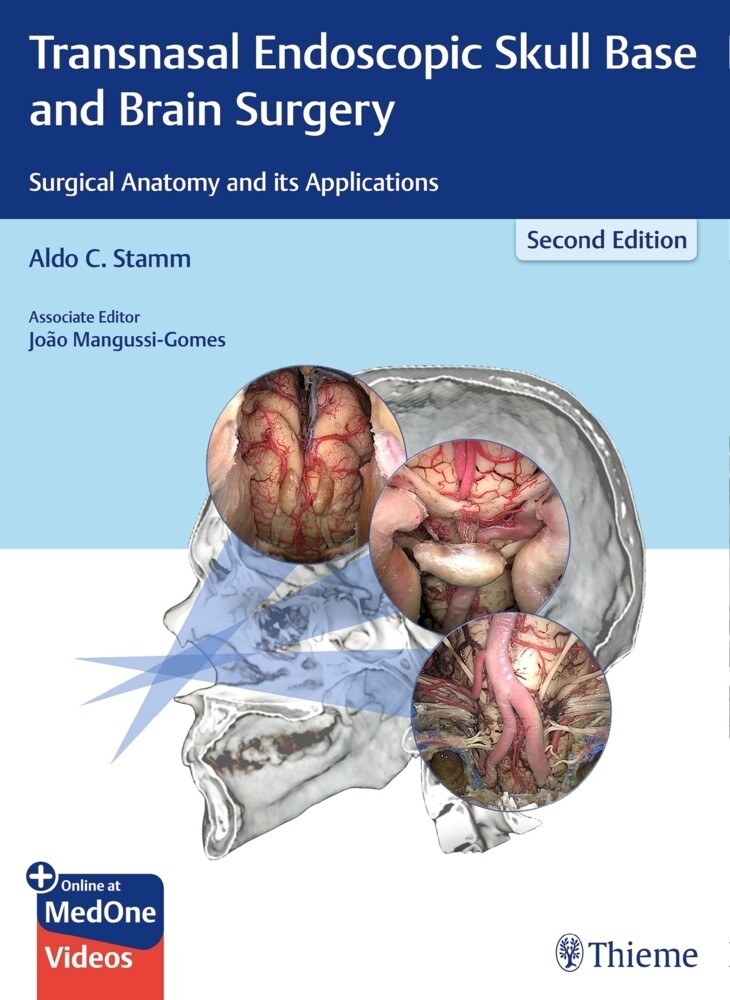 Thumbnail - Transnasal Endoscopic Skull Base And Brain Surgery | Aldo C. Stamm |