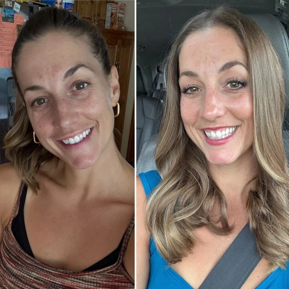 Korean Glass Skin Overnight Repair Hydrogel Bio Collagen Mask Sheets - 35g x 1 - Image 2 of 4