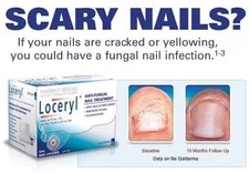 Nail Fun-gal Lacquer 2.5ML FREE & FAST DELIVE...