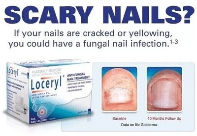 Nail Fun-gal Lacquer 2.5ML FREE & FAST DELIVERY