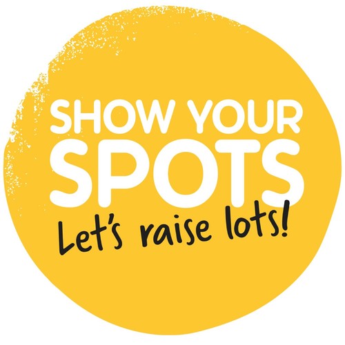 CHILDREN IN NEED SHOW YOUR SPOTS CIRCLE 2 - IRON ON TSHIRT TRANSFERS - A6 A5 A4 - Picture 4 of 5