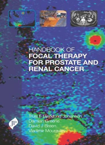 Truls Bjerklund Johansen Dam Handbook of Focal Therapy f (Hardback) (UK IMPORT) - 第 1/1 張圖片