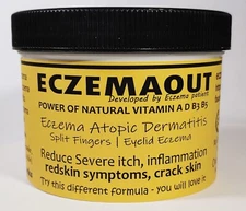 Intense Treatment Cream for Eczema Rosacea Dermatitis Rash 10 oz