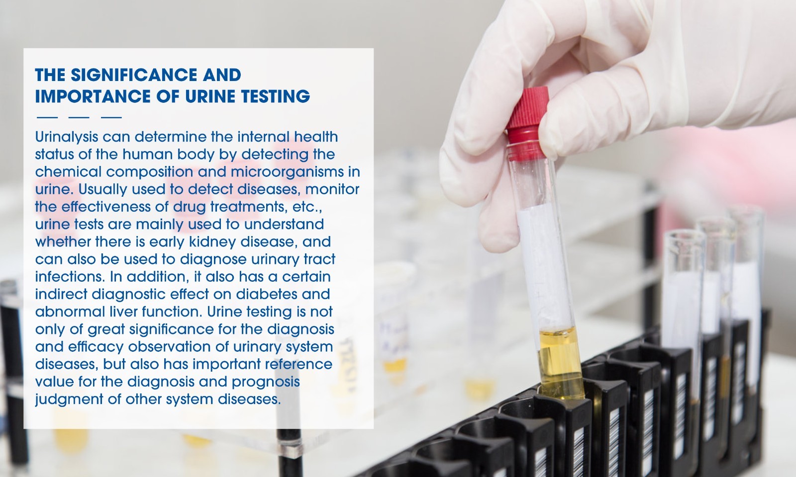 14 Parameter Urinalysis Reagent Urine Test Strips UTI Protien Glucose Leukocyte