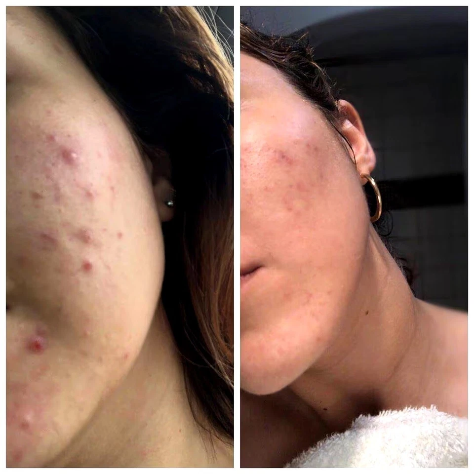 Bioelements Power Peptide Revitalizing Toner 6 oz - Image 3 of 3