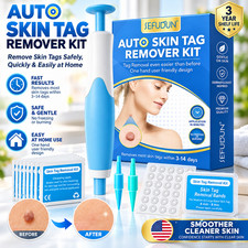 Micro Skin Tag Remover Tool Kit Rubber Bands for Wart Acne Skin Tags Removal USA