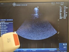 GE 3S-RS Probe for Logiq E Portable Ultrasound