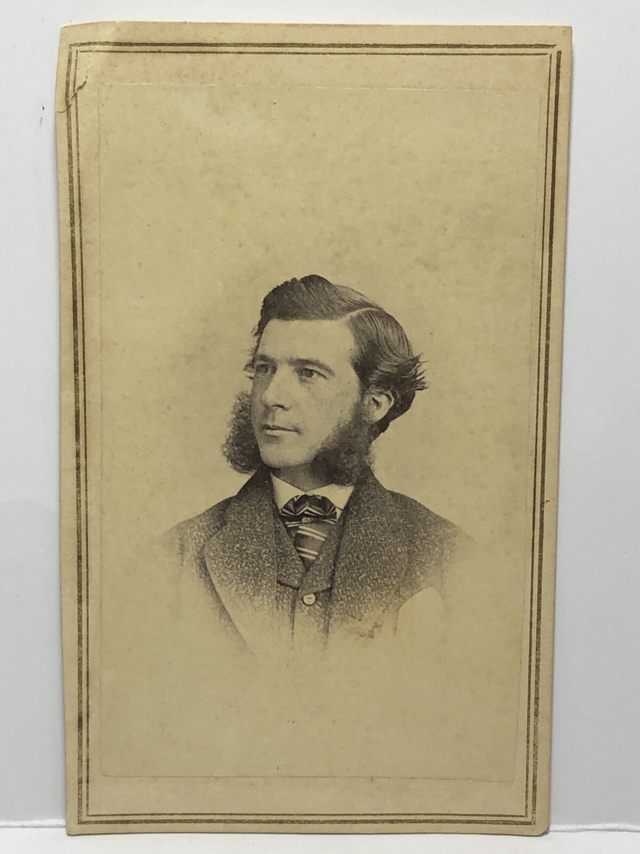 Civil War Tax Stamp CDV Photo Handsome Man Bushy Sideburns