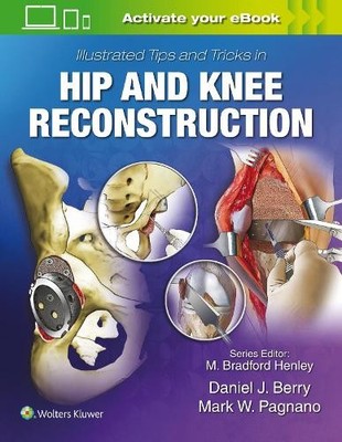 Daniel J. Berry Illustrated Tips and Tricks in Hip and Kn (Hardback) (UK IMPORT)