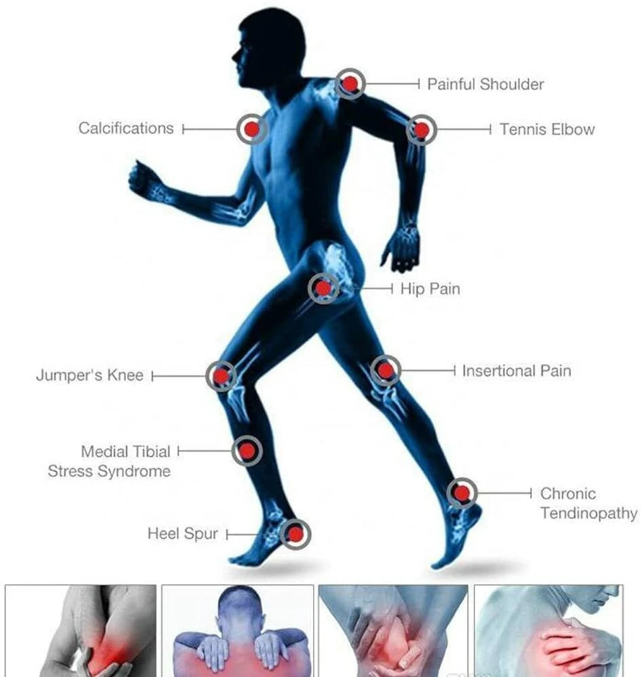 ED Shockwave Therapy Machine Stoßwellentherapie Gerät Stoßwellen Therapiegerät - Bild 3 von 4