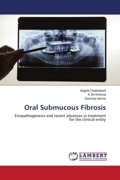 Sagnik Chakrabarti (U. A.) | Oral Submucous Fibrosis | Taschenbuch | Englisch-image