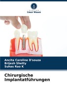 Ancita Caroline D'souza (U. A.) | Chirurgische ImplantatfüHrungen | Taschenbuch