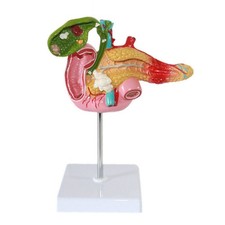 Pancreas Pathology Model Multicolored Mounted Anatomy Display Realistic Texture