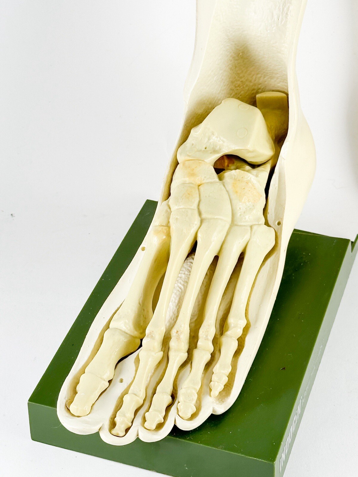 Merck Sharpe & Dome Anatomic Foot Model