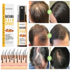 Batana Oil Hair Growth Spray Anti Hair Loss Fast Regrowth Scalp Treatment Serum