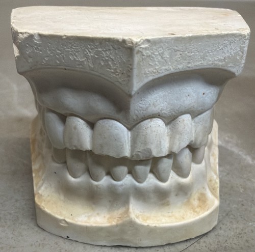Vintage Colombia Dentoform Articulated Teeth-Jaw Full Mouth Model Steam Punk