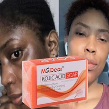 Kojic Acid Skin Brightening Original Kojic Acid Soap for Dark Spot Acne Remover
