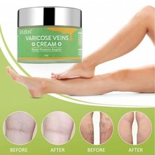 Advanced Varicose Vein Repair Cream Smooth, Calm Restore Skin Appearance