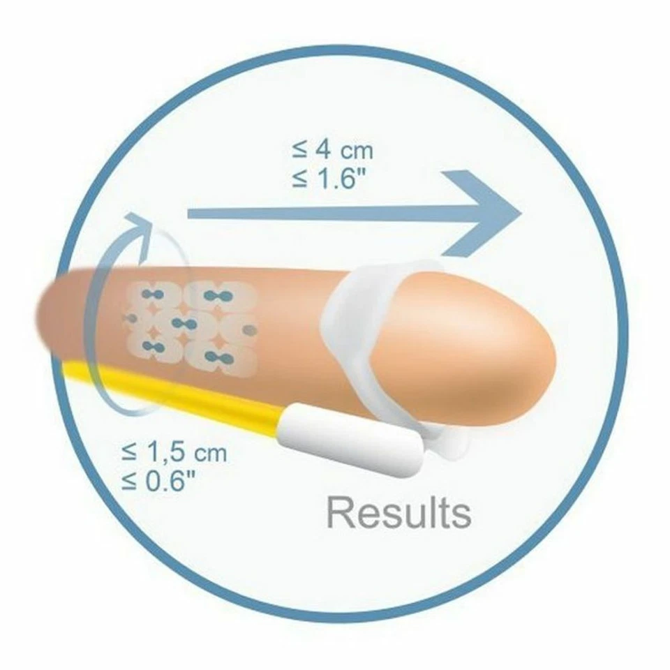 Andropenis Andromedical trattamento per ingrandimento e allungamento del pene - Immagine 2 di 4