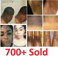 Dark Skin Bleaching Cream Whitening Lightening AHA - Face  Body  15g x 5 Pack