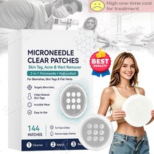 Curalona Microneedle Patches 144pcs, Skin Tag Wart Acne Remover Patches 2026