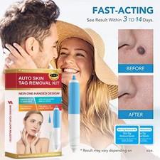 Micro Skin Tag Remover Device Kit Safe Painless Removal 2mm-8 mm Band Tool USA